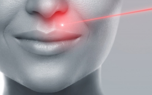 Epilation laser visage femme