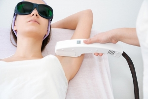 Epilation Laser : Idées Fausses Expliquées par le Dr Cahn à Colmar