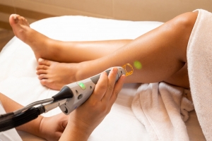 Epilation à Colmar : Laser Epilatoire ou Lampe Flash (IPL)