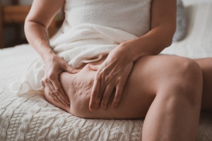Cryolipolyse contre la Cellulite à Colmar, est-ce efficace ?