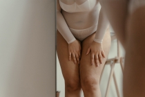 Radiofréquence et Cellulite à Colmar | Capitons Fesses et Cuisses