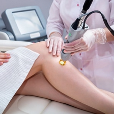 Epilation laser longue durée